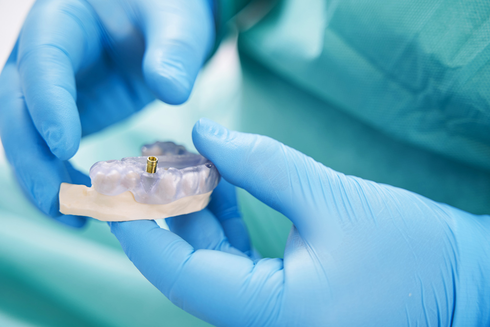 PerleDuLeman implant 2